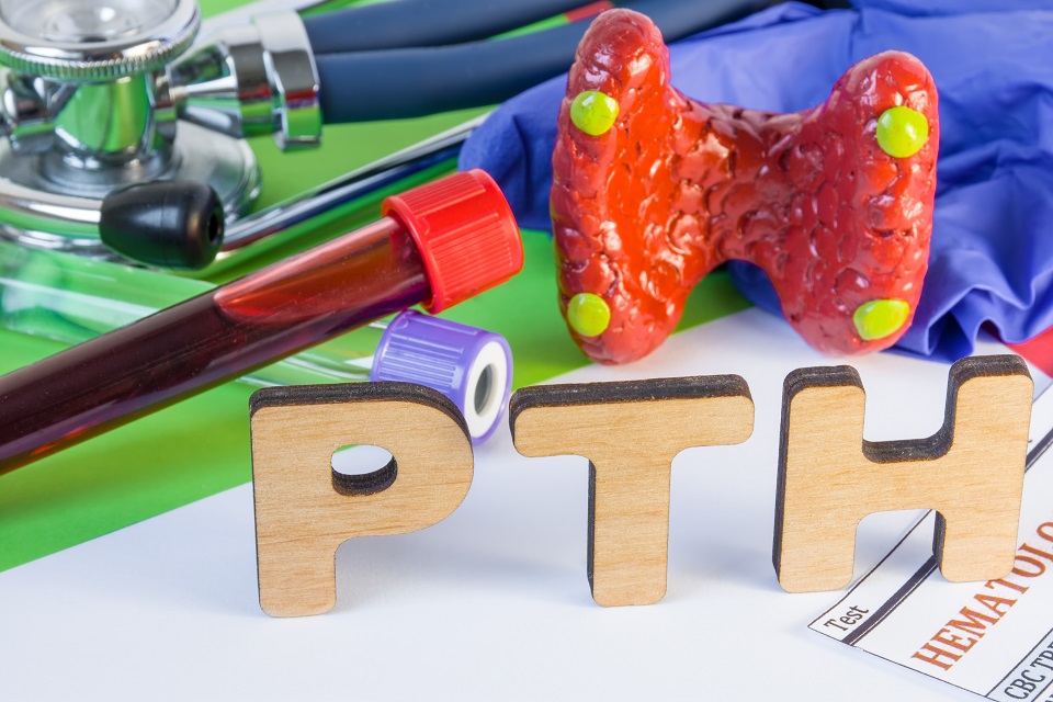 Medical laboratory abbreviation PTH or parathyroid hormone, which is secreted by  parathyroid gland and using his blood test may diagnose organ disease. Word PTH near model of thyroid, lab test tube